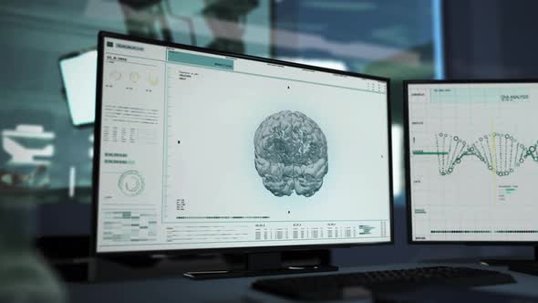 CT Scanner Interface Allows Doctor To Locate Brain Tumor During Examination. alt
