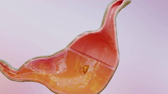 Human Stomach Anatomy Swallowing and Digestion, 3D reander