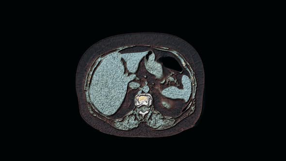 Bulk Multicolored MRI of the Abdominal Cavity, Gastrointestinal Tract, Bladder