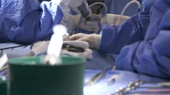 Surgeons working during surgery, close up on hands and instruments.