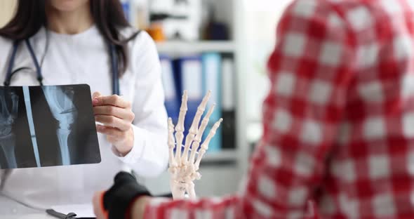 Doctor Talks to Patient with Injured Arm and Shows Xray