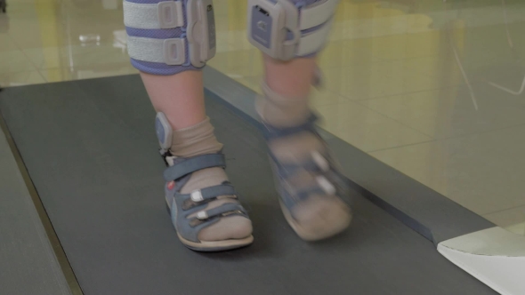 View Of Small Boy Feet On Treadmill In The Special Orthopedic Bandage And Foot Wear