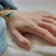 With a Wound on the Arm Removed Stitches at Home - VideoHive Item for Sale