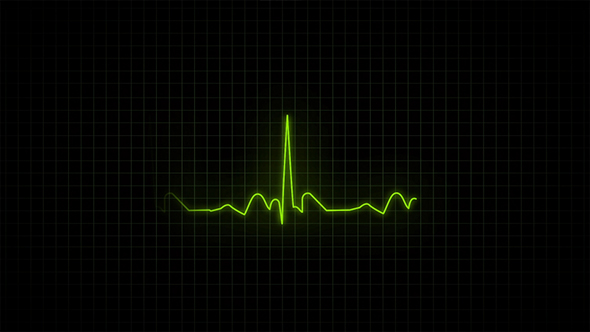 Heartbeat Monitor - Electrocardiogram alt