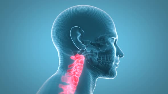 Cervical Vertebrae