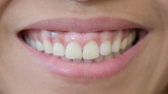 Smiling Mouth of African Woman Lips and Teeth