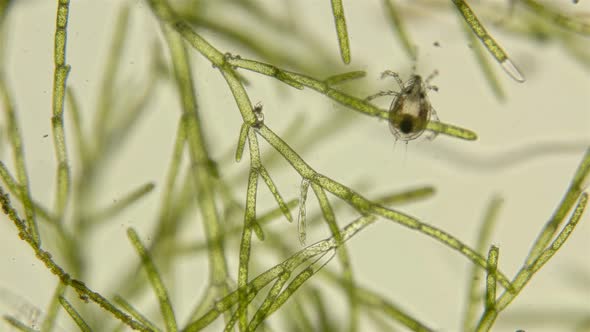 Mite Hydrachnidia Under the Microscope, Live Only in Water