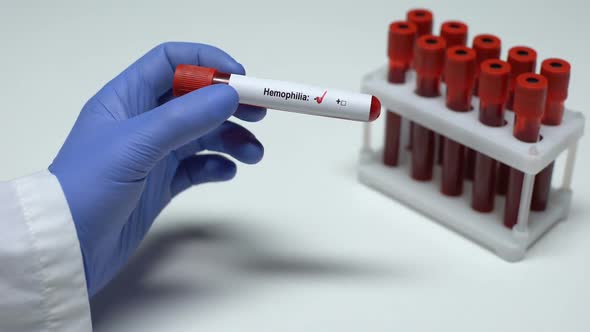 Negative Hemophilia Test, Doctor Showing Blood Sample in Tube, Health Checkup