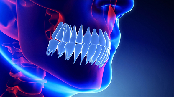Jaw With Teeth Xray Scan alt