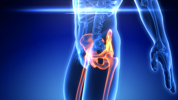 HIP Joint Skeleton Xray Scan