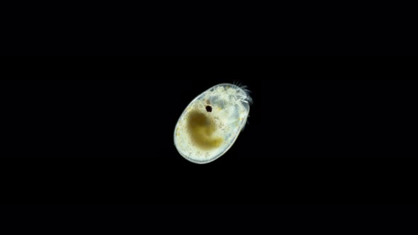 Ostracoda under a microscope, Cypridinidae family, Myodocopida Order