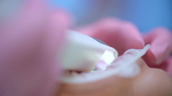 Orthodontist In Pink Gloves Scaning Patient With Dental Intraoral Scanner.