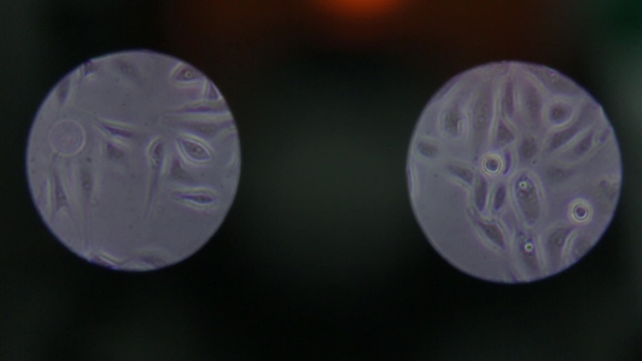 Bacteria Under Microscope Magnified