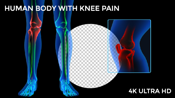 Human Body - Knee Pain