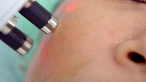 Close Up Shot of Skin Rejuvenation Treatment at Medical Center