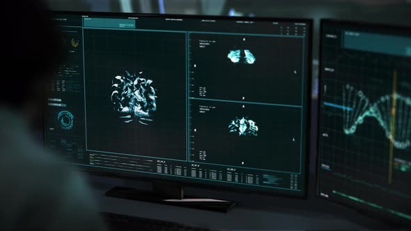 A doctor is supervising the animation of the medical brain diagnostic software