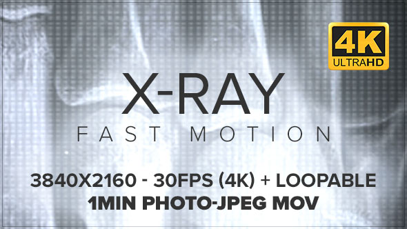 X-Ray : Fast Motion 