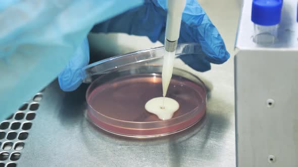 Growing Bacteria in a Petri Dish , Microbiological Analysis