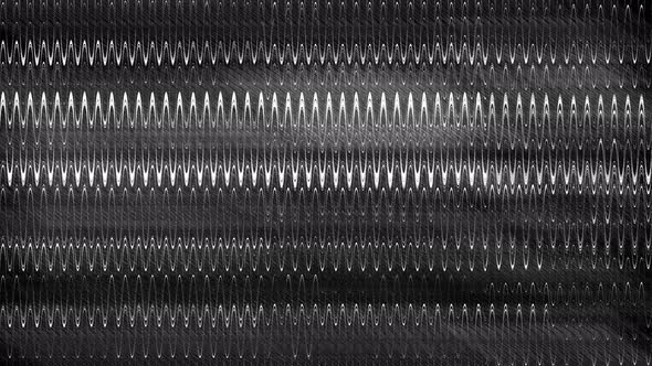 VHS real Defects Noise and Artifacts, Glitches from an Old Tape