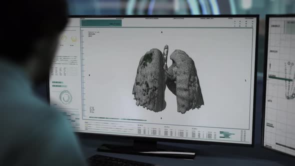 Medical Specialist Watches Results Of Scientific Experiment On Computer Screen alt