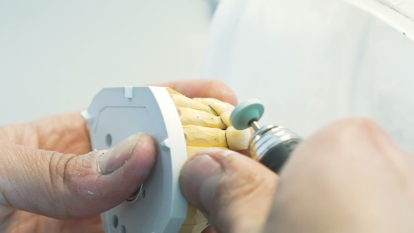 of Grinding Teeth Crowns with Instruments in Dental Lab