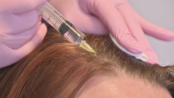 A Beautician Makes Injections of Vitamins and Minerals in the Woman's Scalp to Prevent or Slow the