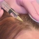 A Beautician Makes Injections of Vitamins and Minerals in the Woman's Scalp to Prevent or Slow the - VideoHive Item for Sale