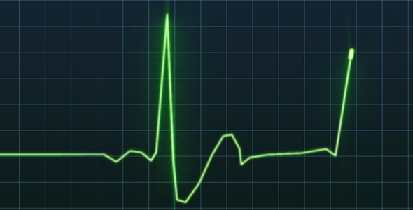 Green Heartbeat Monitor alt