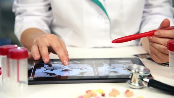 Doctor Examines An X-ray Images Of Patient