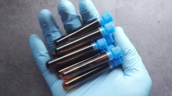 Hand in Blue Medical Gloves Holding Blood Test Tube
