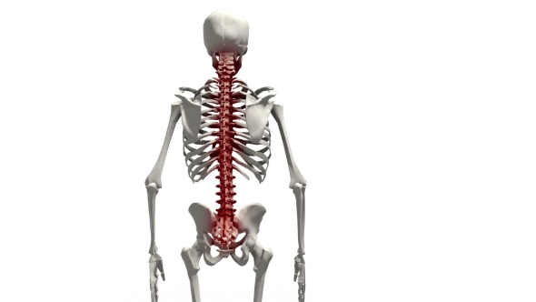 Pain in the Spine of a Human 3D alt