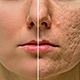 Ultimate Skin Retouch Photoshop Action - GraphicRiver Item for Sale