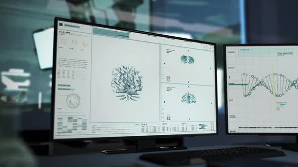 Analysis Of Skull Image Projected On Screen In Modern Hospital Laboratory alt