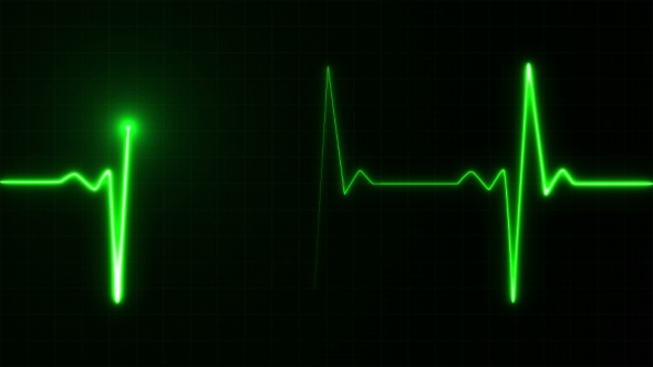 Heart Beat Pulse in Green
