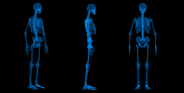 Skeleton X-Ray Artificial Intelligence