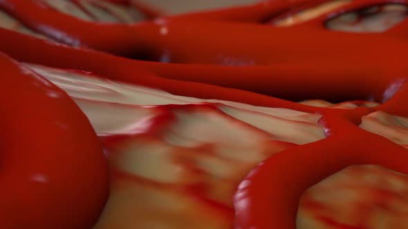 Microbiology video.Bacterial infection in the blood alt