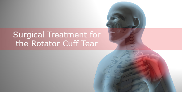 Surgical Treatment For The Rotator Cuff Tear