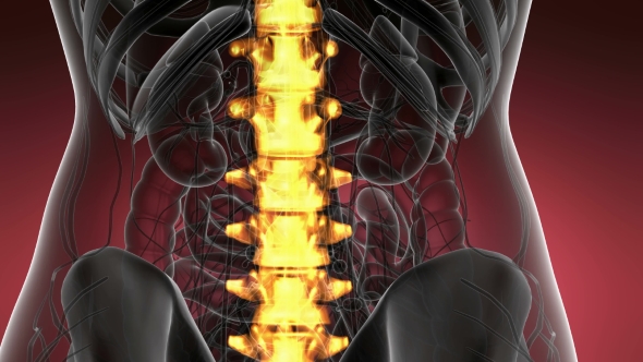 Backache in Back Bones alt