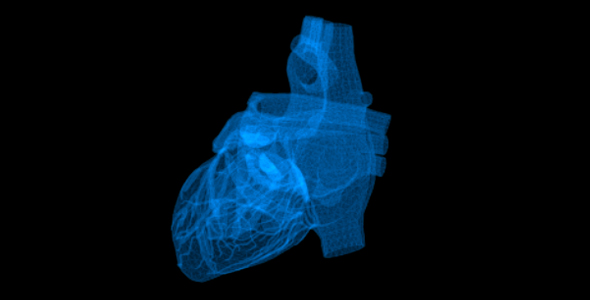 Heart X-Ray Artificial Intelligence alt