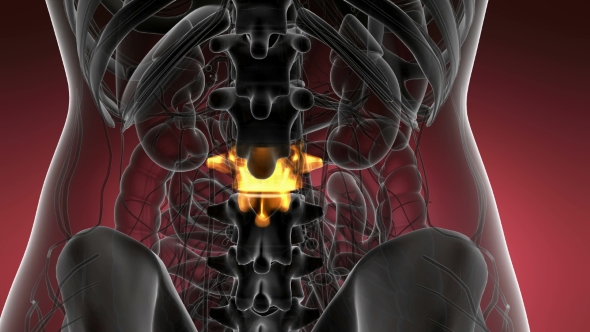 Backache in Back Bones alt