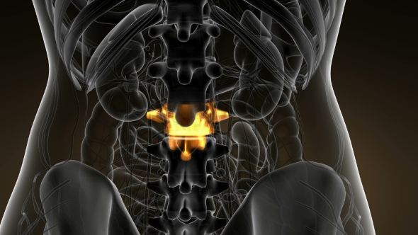 Backache in Back Bones alt