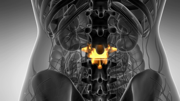 Backache in Back Bones alt