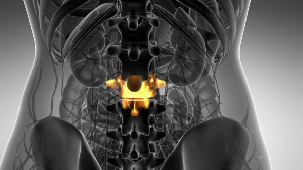 Backache in Back Bones alt