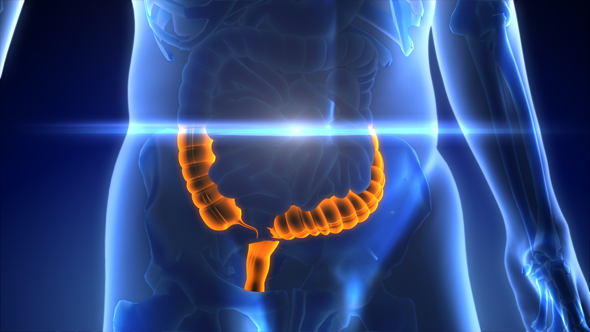 Colon Cancer Diagnosis