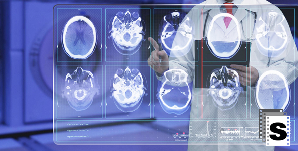 Doctor Looking at MRI alt