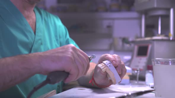 Artificial Tooth Being Done By a Dental Prosthesis Specialist