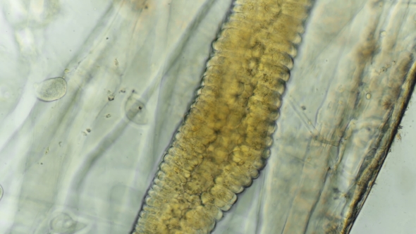 a Transparent Larva Under the Microscope,with Internal Organs,like an Alien Organism