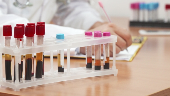 Blood Test Tubes for Medical Tests