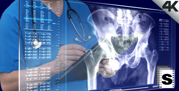 Osteoporosis Examination alt