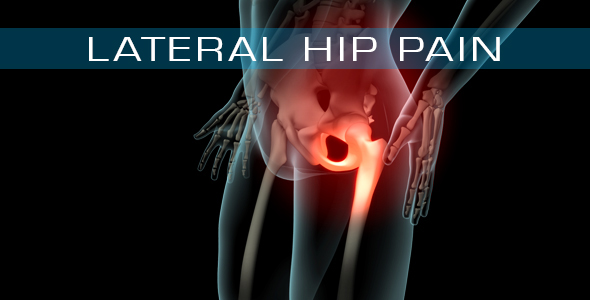 Lateral Hip Pain alt
